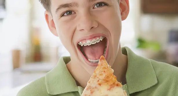 EATING WITH BRACES: WHAT TO BE AWARE OF?