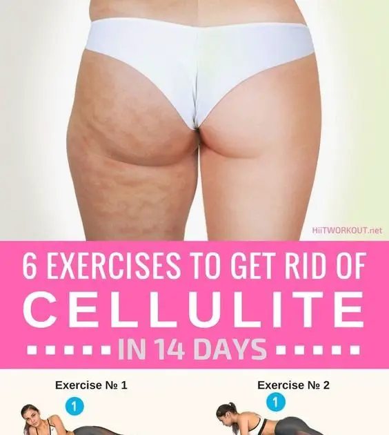 Exercises To Get Rid Of Cottage Cheese Thighs