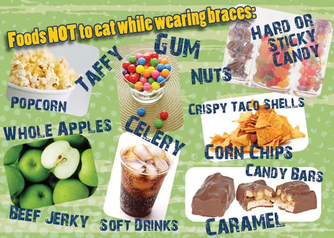 Foods not to eat while wearing braces. www.drdortho.com