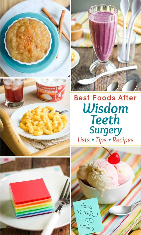 Foods That I Can Eat After Wisdom Teeth Removal
