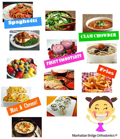 OK Foods to Eat While in Braces
