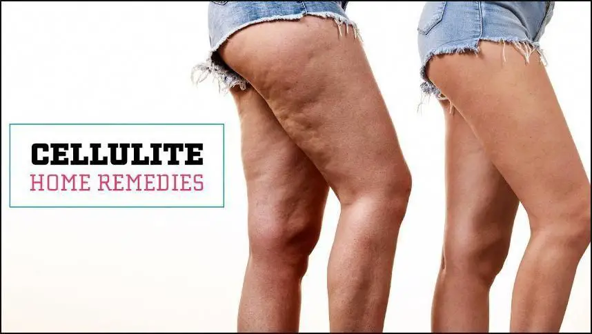 Pin on cellulite remedies